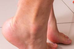img_1969