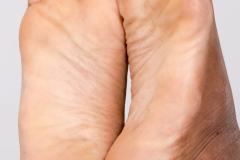 ploy_feet.308